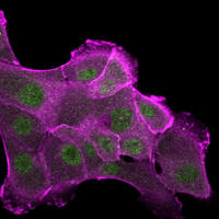 New computational process could help condense decades of disease biology research into days